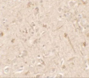 Anti-IL1F6 antibody used in IHC (Paraffin sections) (IHC-P). GTX31555