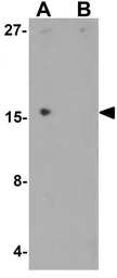 Anti-IL1F6 antibody used in Western Blot (WB). GTX31555