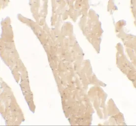 Anti-IL1F5 antibody used in IHC (Paraffin sections) (IHC-P). GTX31556