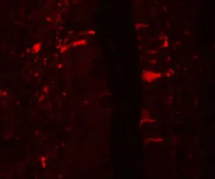 Anti-IL1F5 antibody used in IHC (Paraffin sections) (IHC-P). GTX31556