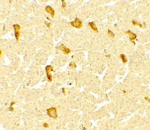 Anti-CERD4 antibody used in IHC (Paraffin sections) (IHC-P). GTX31560