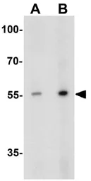 Anti-APPBP2 antibody used in Western Blot (WB). GTX31561