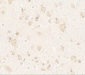 Anti-ULK4 antibody used in IHC (Paraffin sections) (IHC-P). GTX31562