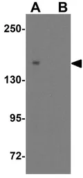 Anti-ULK4 antibody used in Western Blot (WB). GTX31562