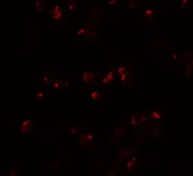 Anti-IL22 antibody used in Immunocytochemistry/ Immunofluorescence (ICC/IF). GTX31563