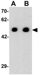 Anti-Arrestin C antibody used in Western Blot (WB). GTX31565