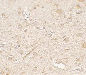 Anti-MP1 antibody used in IHC (Paraffin sections) (IHC-P). GTX31568