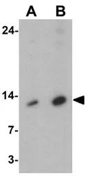 Anti-MP1 antibody used in Western Blot (WB). GTX31568
