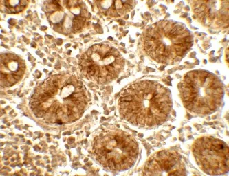 Anti-IFIT1 antibody used in IHC (Paraffin sections) (IHC-P). GTX31570