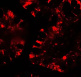 Anti-IFIT1 antibody used in IHC (Paraffin sections) (IHC-P). GTX31570