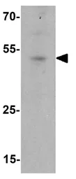 Anti-IFIT1 antibody used in Western Blot (WB). GTX31570