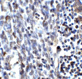 Anti-SMURF2 antibody used in IHC (Paraffin sections) (IHC-P). GTX31571
