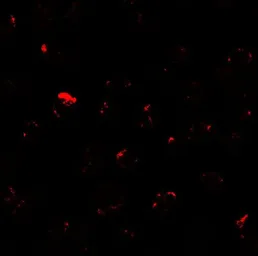 Anti-MIB1 antibody used in Immunocytochemistry/ Immunofluorescence (ICC/IF). GTX31573