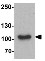 Anti-MIB1 antibody used in Western Blot (WB). GTX31573
