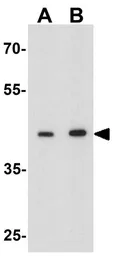 Anti-Deptor antibody used in Western Blot (WB). GTX31575