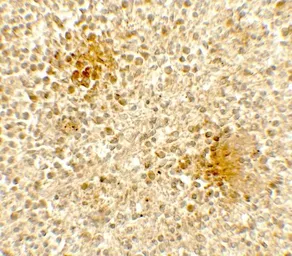 Anti-DOCK8 antibody used in IHC (Paraffin sections) (IHC-P). GTX31578
