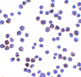 Anti-LIN54 antibody used in Immunocytochemistry/ Immunofluorescence (ICC/IF). GTX31591