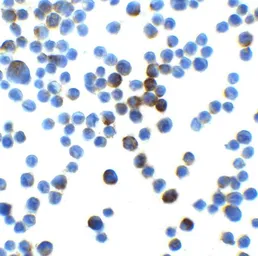 Anti-LIN54 antibody used in Immunocytochemistry/ Immunofluorescence (ICC/IF). GTX31591