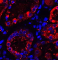 Anti-TXNIP antibody used in IHC (Paraffin sections) (IHC-P). GTX31592