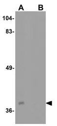 Anti-TXNIP antibody used in Western Blot (WB). GTX31592