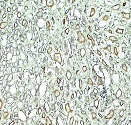Anti-Rubicon antibody used in IHC (Paraffin sections) (IHC-P). GTX31593