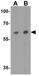 Anti-Vezatin antibody used in Western Blot (WB). GTX31594