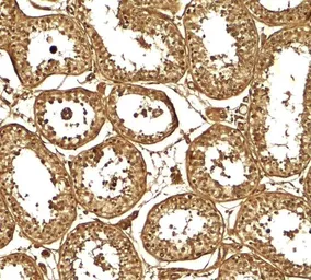 Anti-AKAP 82 antibody used in IHC (Paraffin sections) (IHC-P). GTX31595