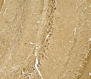 Anti-NINJ1 antibody used in IHC (Paraffin sections) (IHC-P). GTX31596