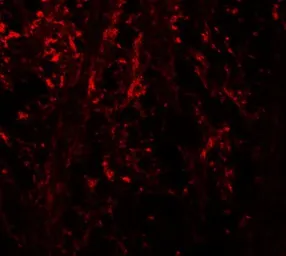 Anti-NINJ1 antibody used in IHC (Paraffin sections) (IHC-P). GTX31596