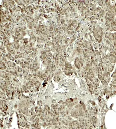 Anti-KIRREL2 antibody used in IHC (Paraffin sections) (IHC-P). GTX31598