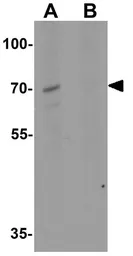 Anti-KIRREL2 antibody used in Western Blot (WB). GTX31598