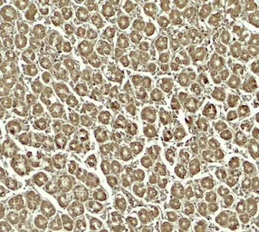 Anti-SKI2W antibody used in IHC (Paraffin sections) (IHC-P). GTX31599