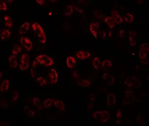 Anti-SKI2W antibody used in IHC (Paraffin sections) (IHC-P). GTX31599