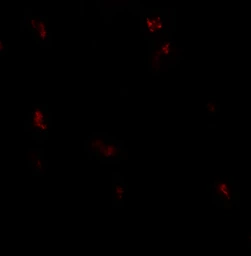 Anti-SKI2W antibody used in IHC (Paraffin sections) (IHC-P). GTX31599