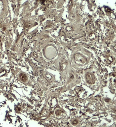 Anti-SKI2W antibody used in IHC (Paraffin sections) (IHC-P). GTX31599
