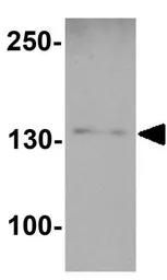 Anti-SKI2W antibody used in Western Blot (WB). GTX31599