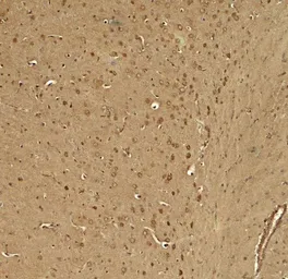 Anti-KCNK1 antibody used in IHC (Paraffin sections) (IHC-P). GTX31601