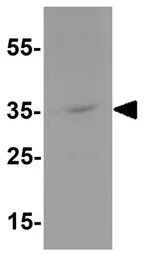 Anti-KCNK1 antibody used in Western Blot (WB). GTX31601
