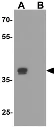Anti-KLF17 antibody used in Western Blot (WB). GTX31603