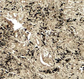 Anti-Wip1 antibody used in IHC (Paraffin sections) (IHC-P). GTX31604