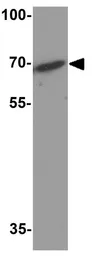 Anti-Wip1 antibody used in Western Blot (WB). GTX31604