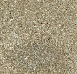 Anti-DTX4 antibody used in IHC (Paraffin sections) (IHC-P). GTX31606