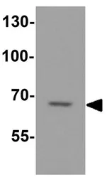 Anti-DTX4 antibody used in Western Blot (WB). GTX31606