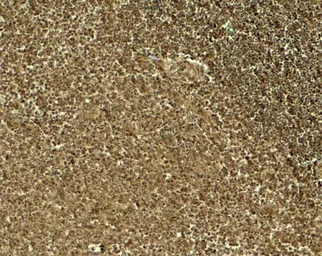 Anti-Jagged 1 antibody used in IHC (Paraffin sections) (IHC-P). GTX31607