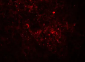 Anti-Jagged 1 antibody used in IHC (Paraffin sections) (IHC-P). GTX31607