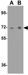 Anti-PJA1 antibody used in Western Blot (WB). GTX31608