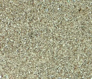 Anti-MALT1 antibody used in IHC (Paraffin sections) (IHC-P). GTX31609