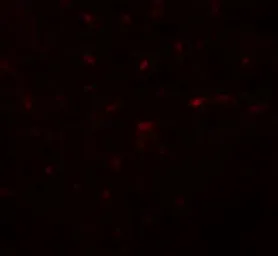 Anti-TRIB3 antibody used in IHC (Paraffin sections) (IHC-P). GTX31610