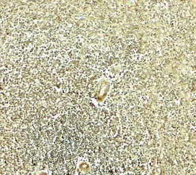 Anti-HELIOS antibody used in IHC (Paraffin sections) (IHC-P). GTX31612
