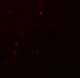 Anti-HELIOS antibody used in IHC (Paraffin sections) (IHC-P). GTX31612